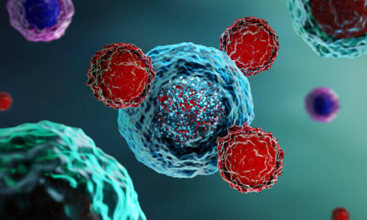 Stages of cancer, and what do they mean  