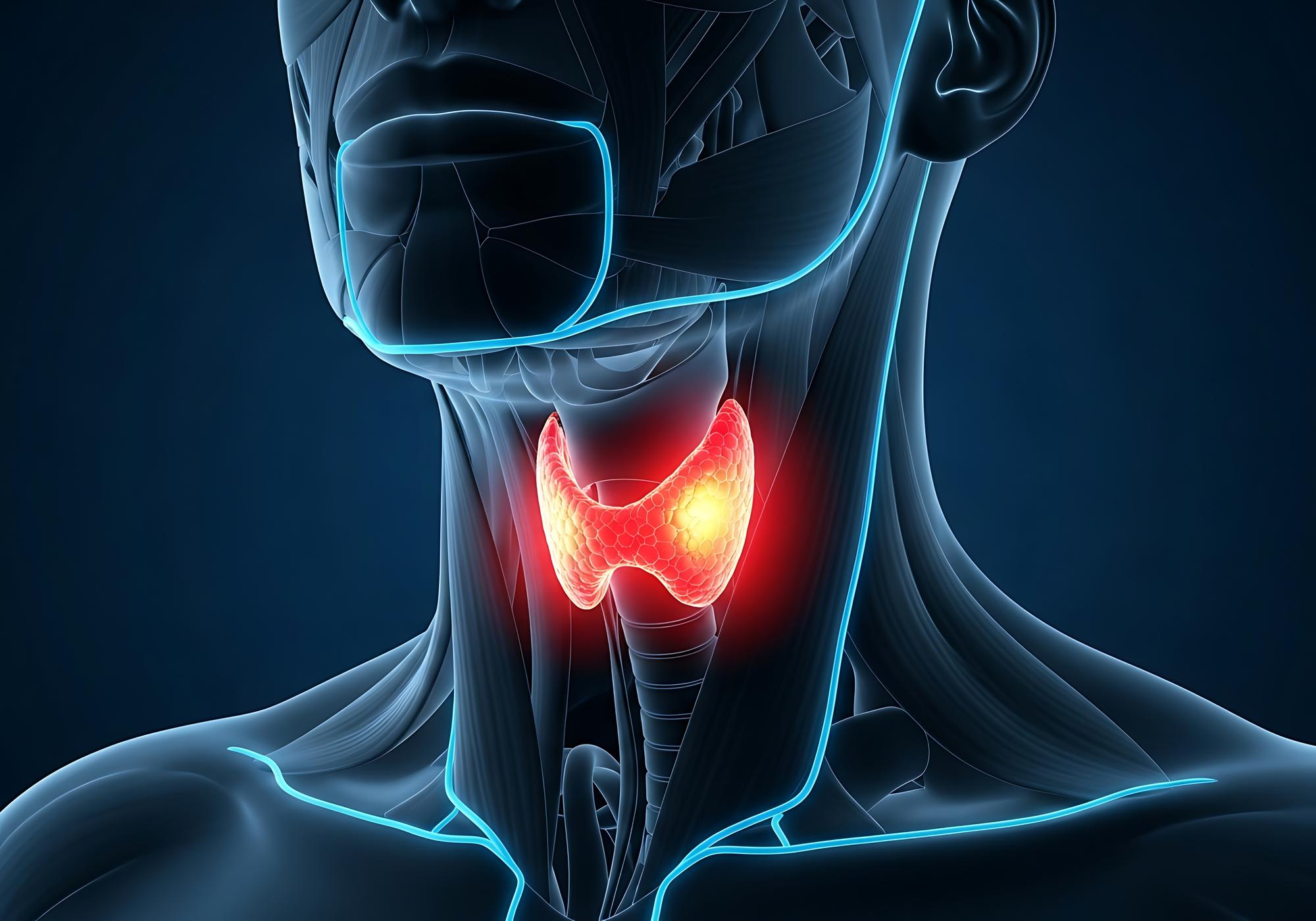 Thyroid Cancer in Young Adults: Rising Incidence and What It Means